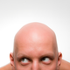 Image for article titled Why Haven't Bald Men Gone Extinct?